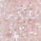 Dusty Pink Glitter